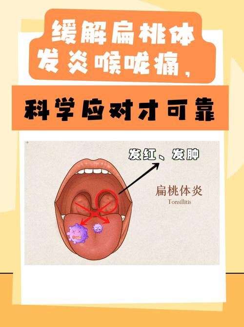 关于“疫情嗓子疼”你可能想知道-第2张图片 关于“疫情嗓子疼”你可能想知道-第2张图片