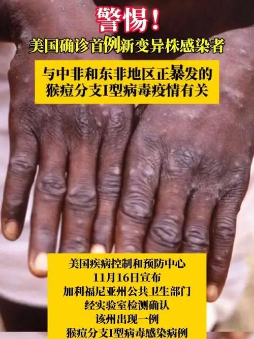美国新冠疫情出现多个新特征/美国新冠疫情发展情况-第7张图片 美国新冠疫情出现多个新特征/美国新冠疫情发展情况-第7张图片