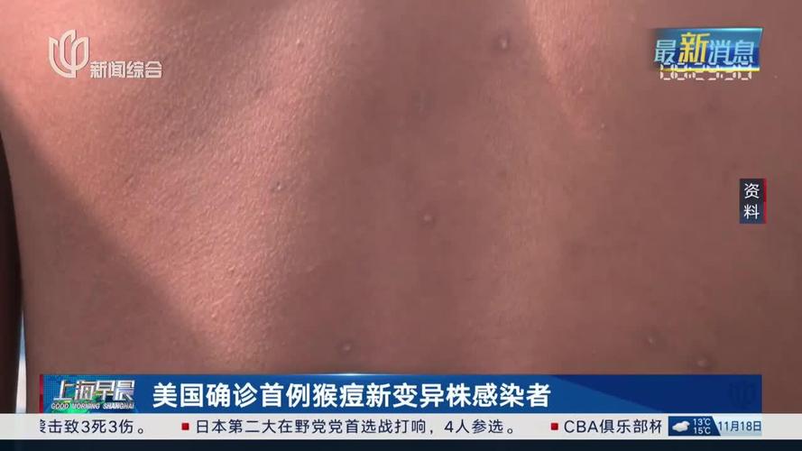 美国新冠疫情出现多个新特征/美国新冠疫情发展情况-第10张图片 美国新冠疫情出现多个新特征/美国新冠疫情发展情况-第10张图片
