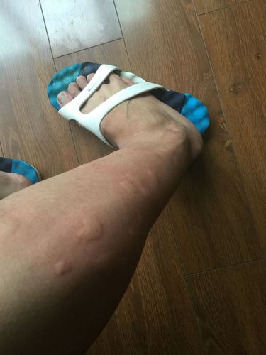 关于“广东登革热疫情”你可能想知道-第3张图片 关于“广东登革热疫情”你可能想知道-第3张图片