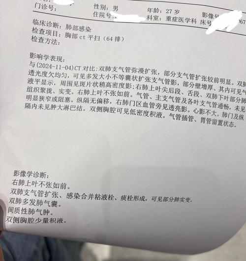 克拉玛依疫情,克拉玛依疫情第一次封门是哪天开始的-第5张图片 克拉玛依疫情,克拉玛依疫情第一次封门是哪天开始的-第5张图片