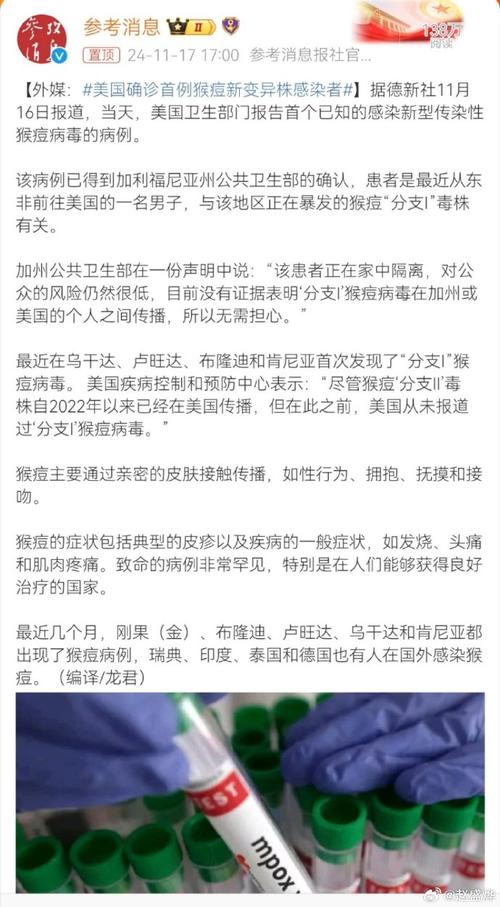 美媒质疑美疫情数据，美国疫情报告疑遭操纵