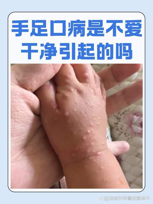 安徽疗法疫情/安徽疫情患者-第5张图片 安徽疗法疫情/安徽疫情患者-第5张图片