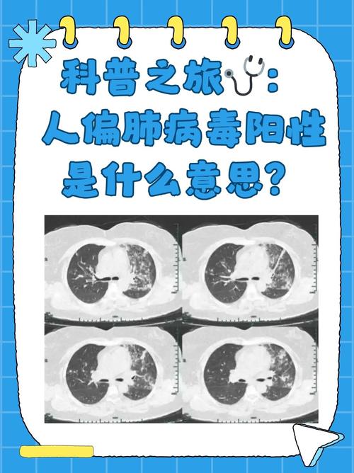 关于“疫情期间”你可能想知道-第6张图片 关于“疫情期间”你可能想知道-第6张图片