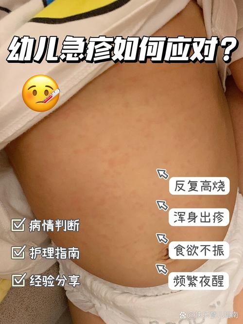 关于“安徽传染病疫情”你可能想知道-第6张图片